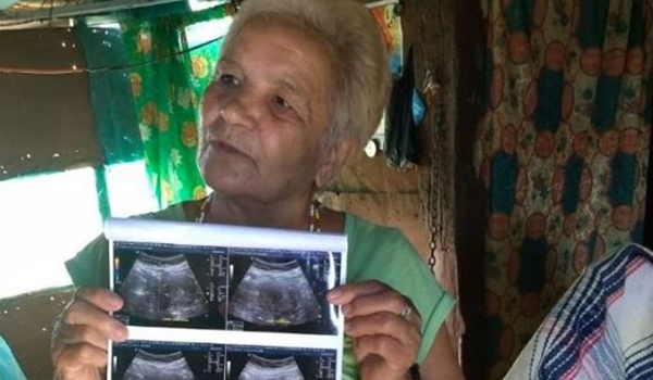En mexico una mujer de 70 años asegura que está embarazada