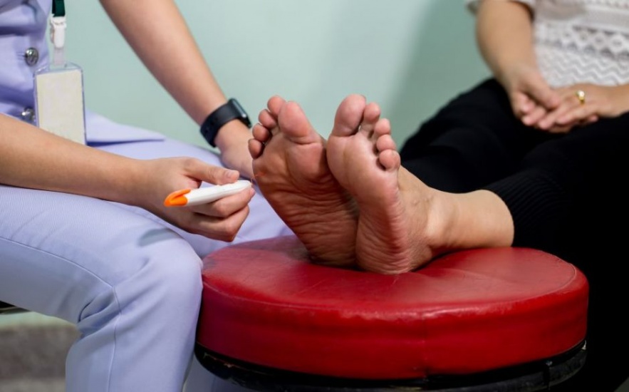 ¿Cuáles son los síntomas y tratamientos para el pie diabético?
