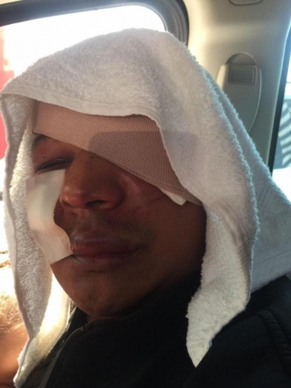 Seis hombres agredieron a golpes de forma brutal al locutor Sandy Sandy