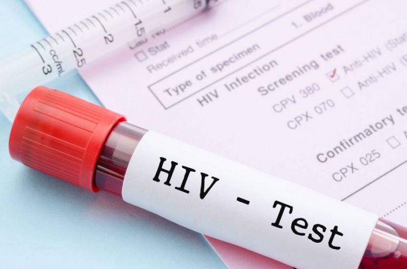 Encuentran un nuevo subtipo del VIH