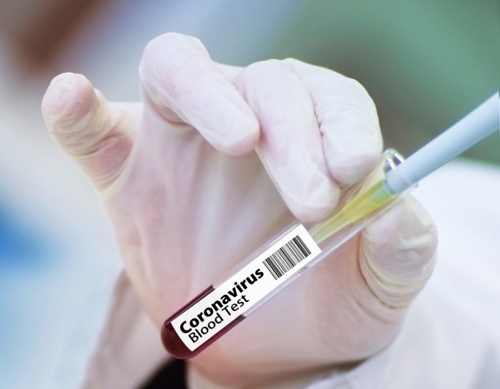 55 muertes por coronavirus en tres días en República Dominicana; suman 897