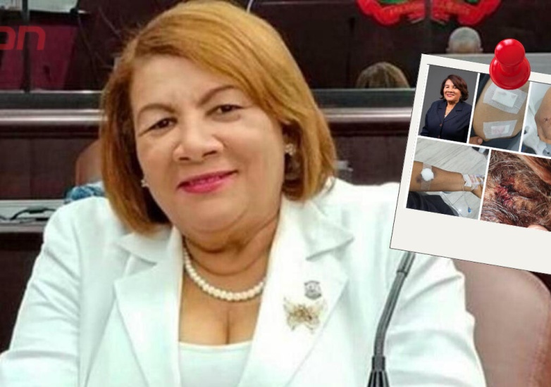 Candidata a diputada Cleo Sánchez fue herida por un extraño dentro de su hogar