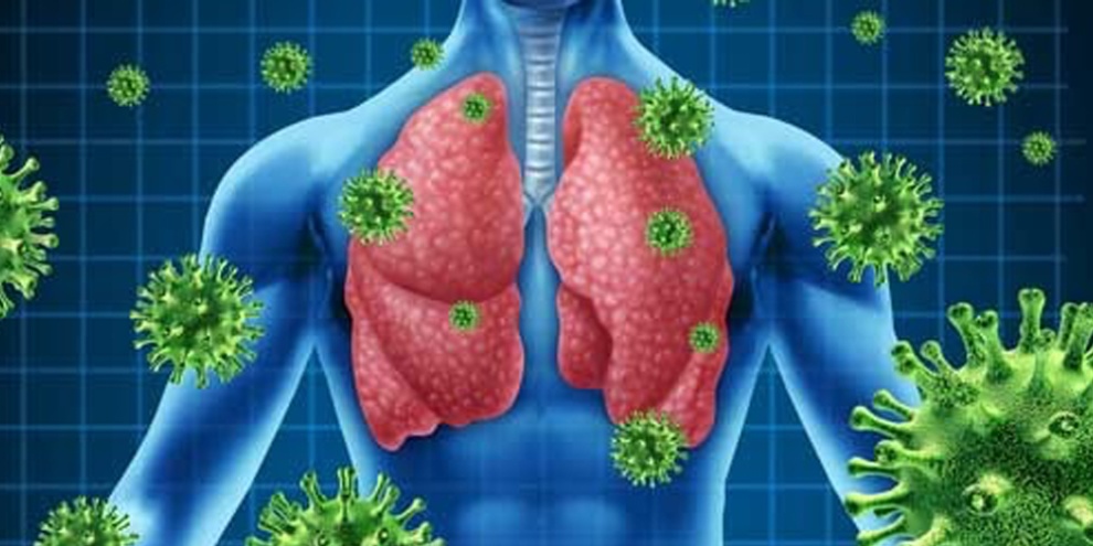 Salud Pública detecta en lo que va de año es de 183 casos sospechosos de Infección Respiratoria Aguda Grave (IRAG)
