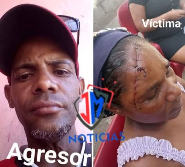 Las autoridades tras la pista de hombre que agredió a su ex pareja sentimental en la ciudad de Azua
