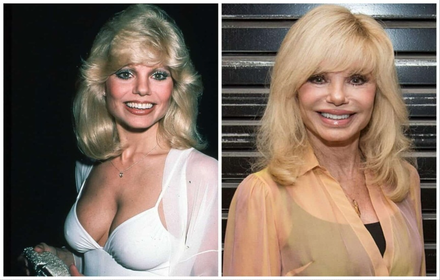 Murió la actriz  Loni Anderson, a los 79 años